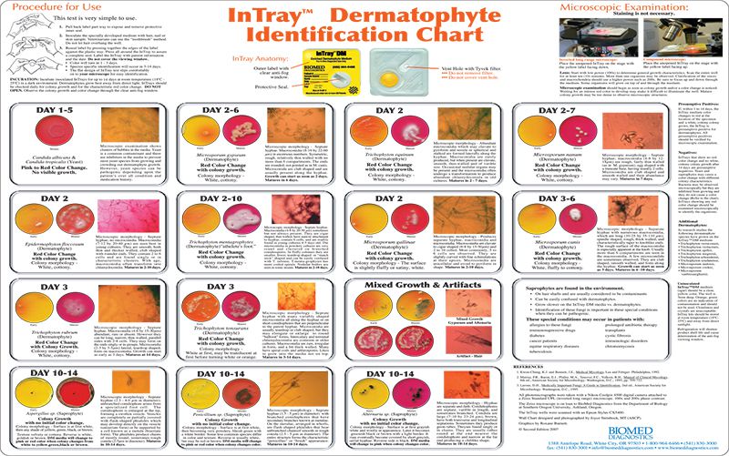 Large DM Wall Chart / 22 X 28